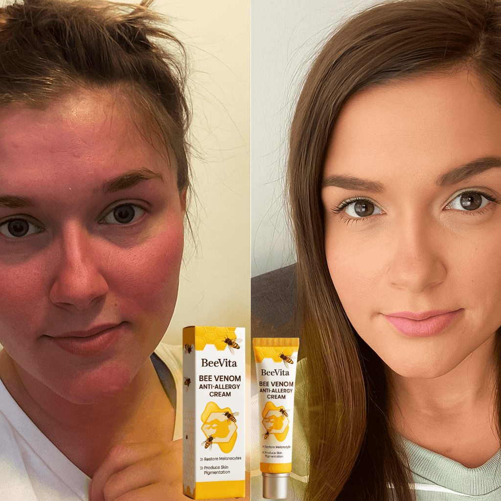 Before and after use of BeeVita Anti-Allergy Cream, showcasing reduced redness and improved skin appearance.